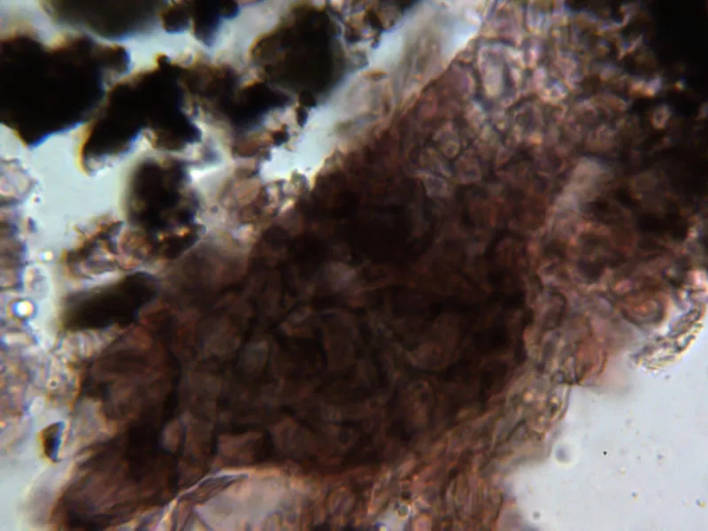 Apiospora montagnei 18 - Excípulo